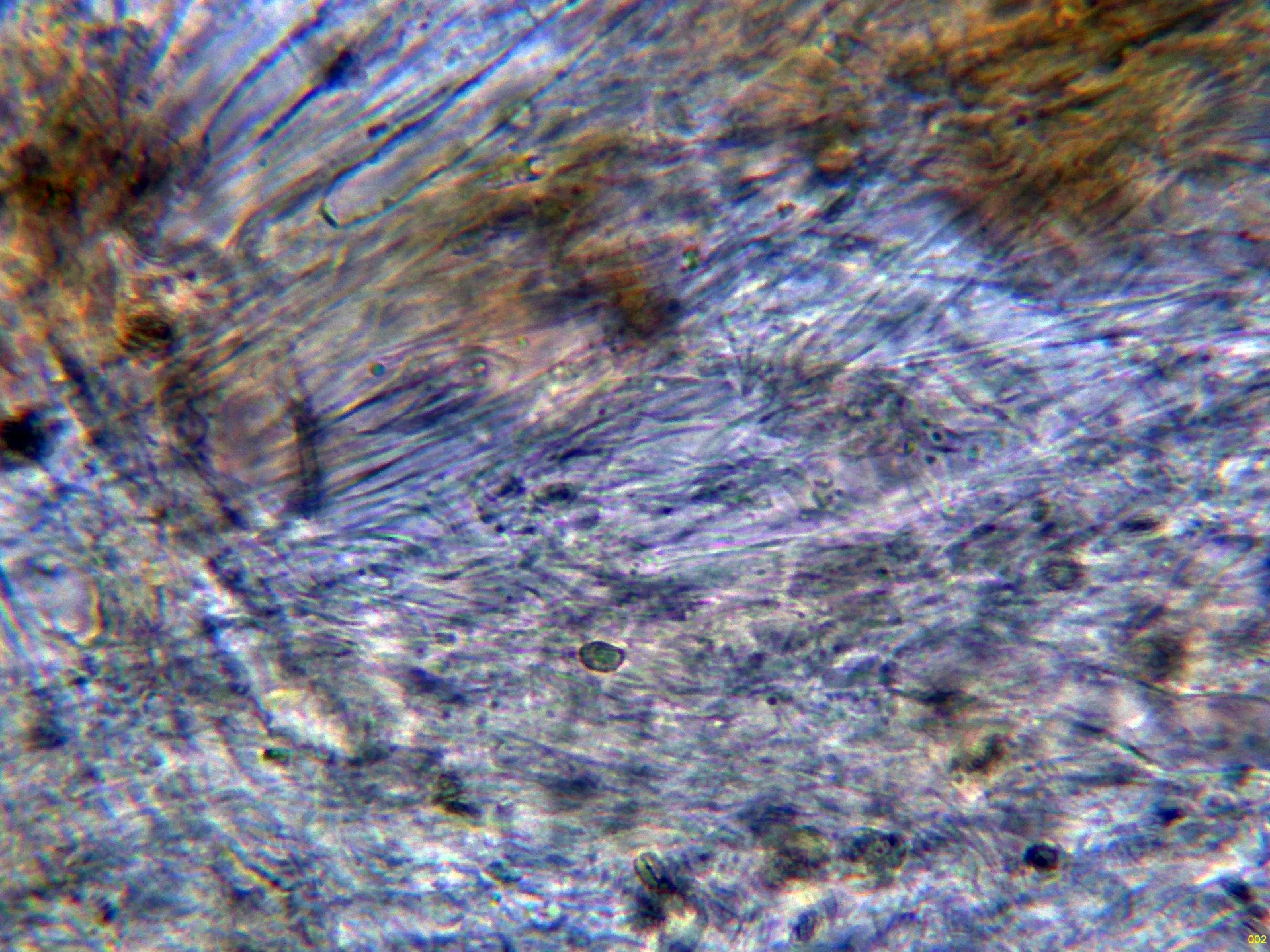Microscopía de Phaeoclavulina curta - 3 - Hifas trama-002